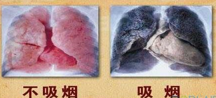 室内二手烟危害甚于直接吸烟